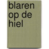 Blaren op de hiel by Annet Peetoom