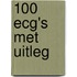 100 ecg's met uitleg