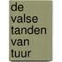 De valse tanden van Tuur