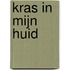 Kras in mijn huid