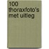 100 thoraxfoto's met uitleg