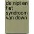De NIPT en het syndroom van Down