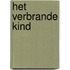 Het verbrande kind