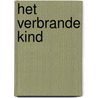 Het verbrande kind by Stig Dagerman