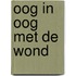 Oog in oog met de wond