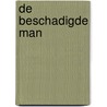 De beschadigde man by Aleidis Dierick